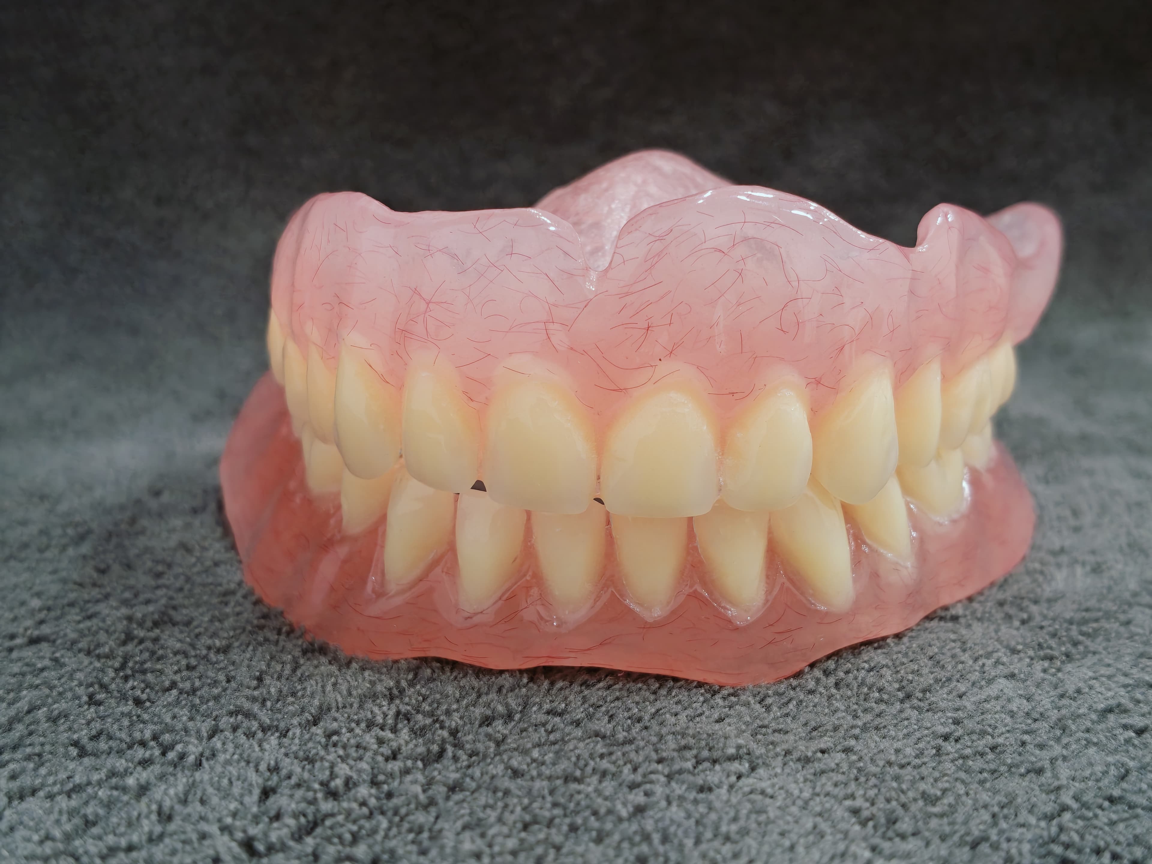 Complete Denture