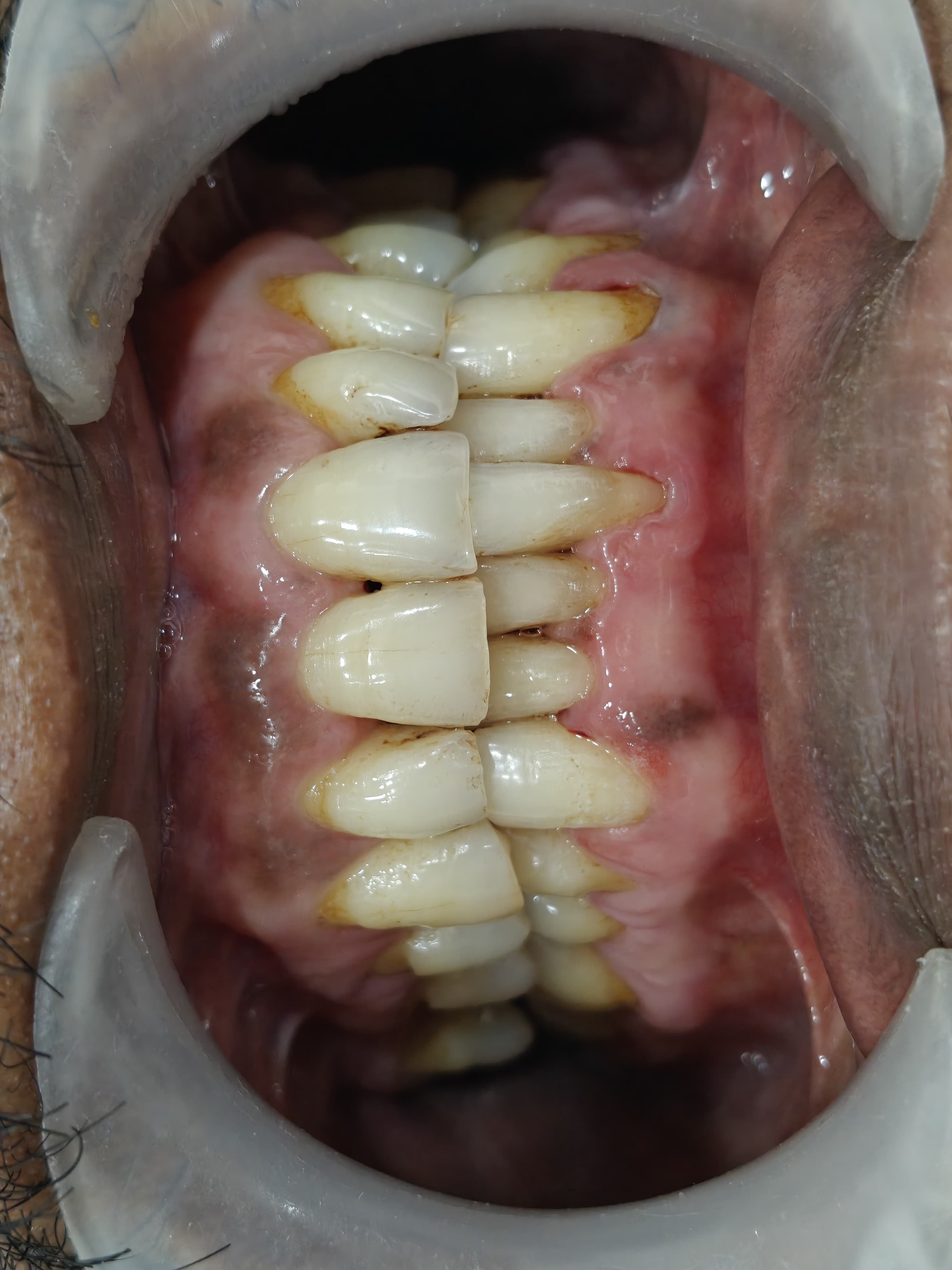 Pre-Treatment Assessment