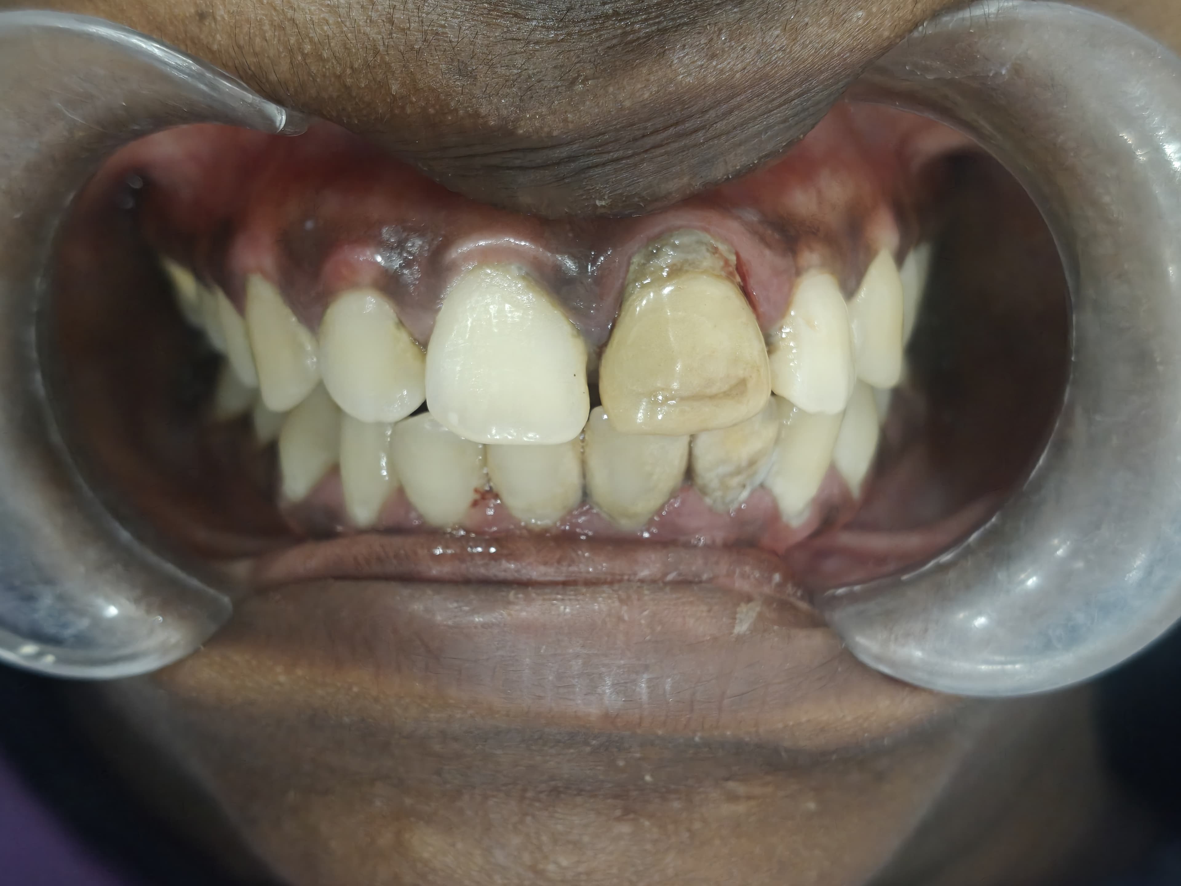 Pre-Treatment Evaluation